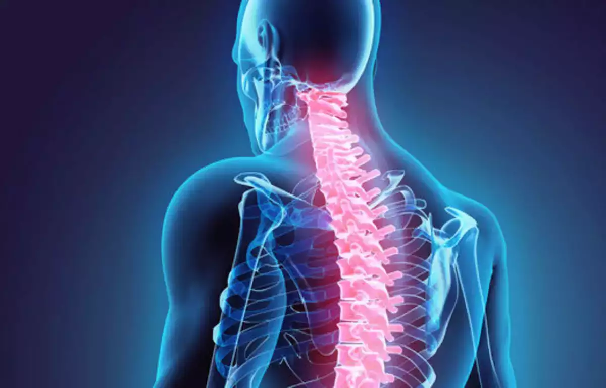 Endoskopik Omurga Cerrahisinin Avantajları ve Riskleri Nelerdir?